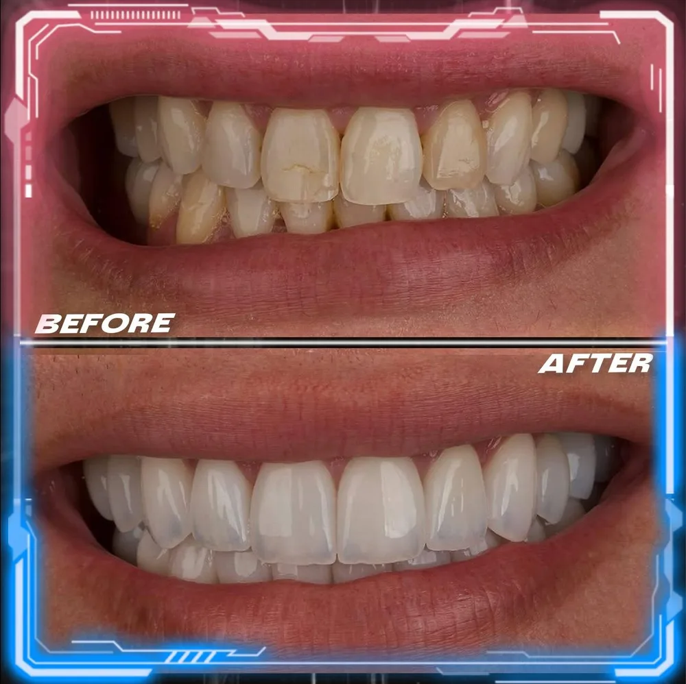 Case 01: a smile transformed at Cronos Dental