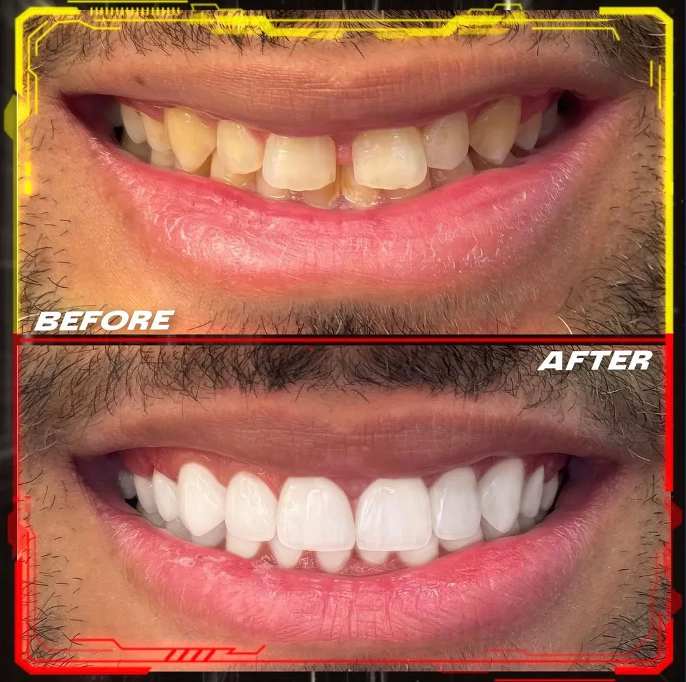 Case 03: a smile transformed at Cronos Dental