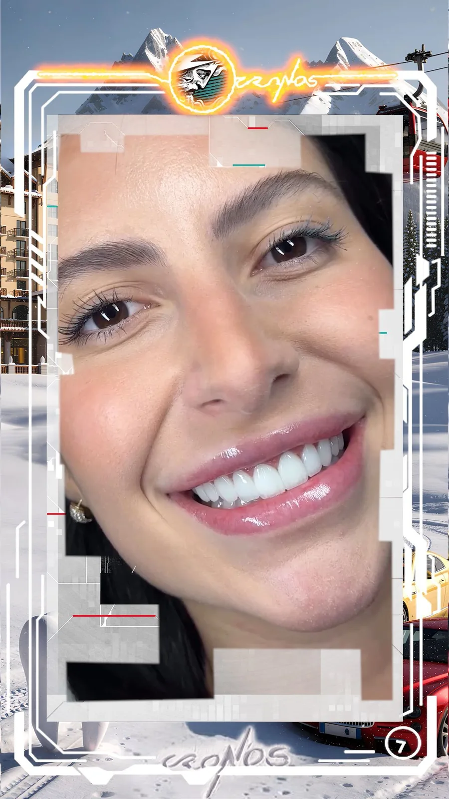 A smile transformed at Cronos Dental, photo 3