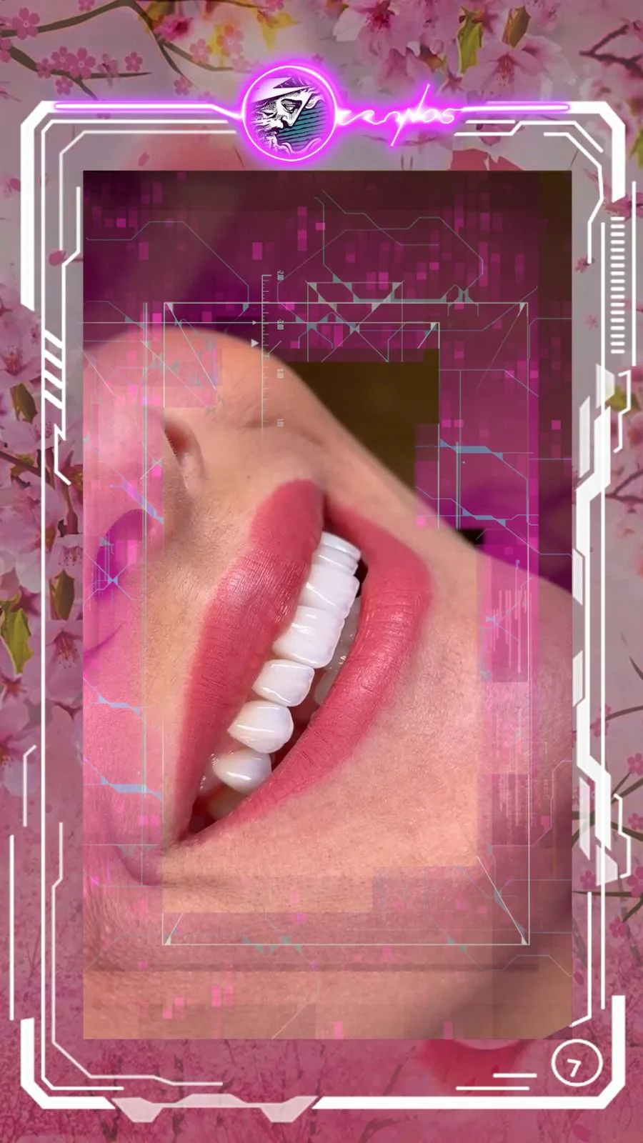 A smile transformed at Cronos Dental, photo 5
